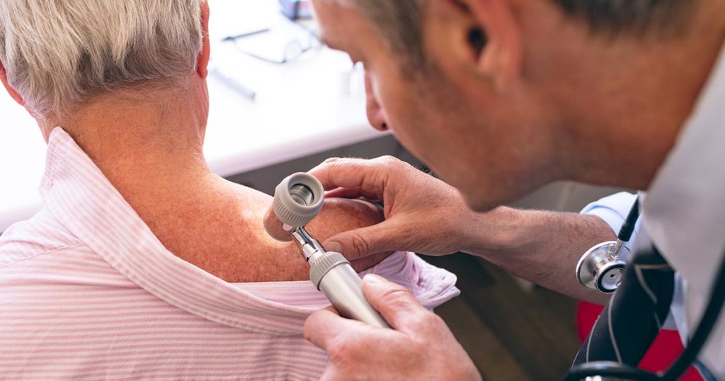 Sim, melanoma dá direito a isenção de Imposto de Renda. Entenda como