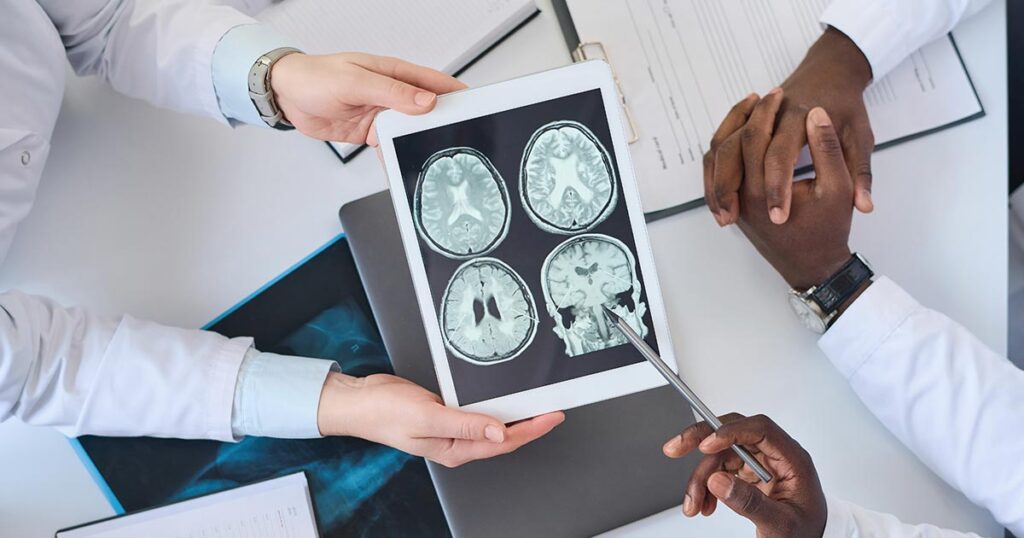 Quem tem epilepsia consegue algum benefício previdenciário?