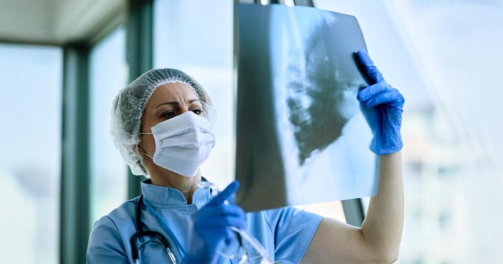 Tuberculose ativa gera isenção no imposto de renda?